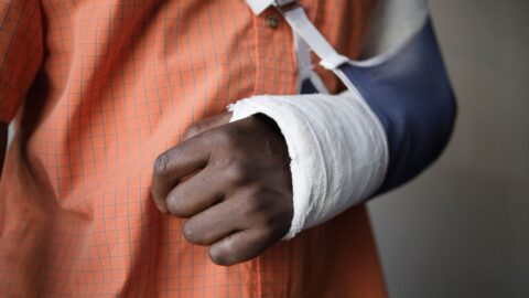 injured man with an arm cast